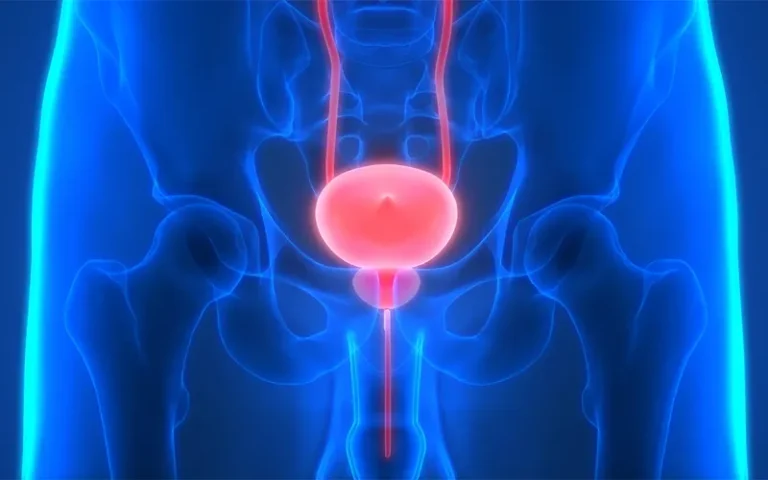 Advanced prostate cancer